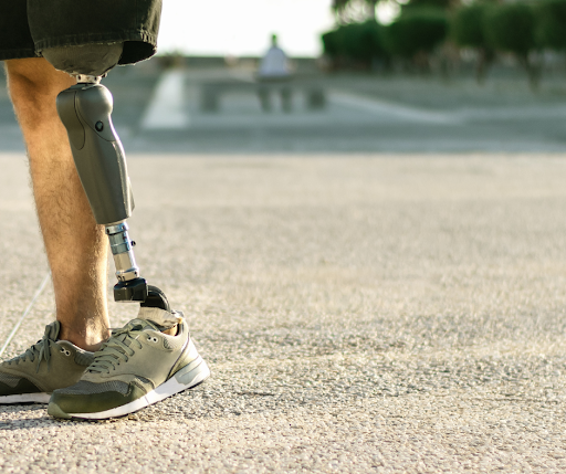 Man wearing prosthetic left leg with parts made by Winchester Interconnect